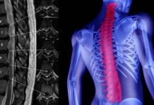 The NCX3 gene amplifies pain signals within the spinal cord