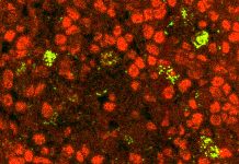 Thymus gland educates nascent immune cells by exposing them to proteins made by thymus cells that mimic various tissues throughout the body