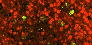 Thymus gland educates nascent immune cells by exposing them to proteins made by thymus cells that mimic various tissues throughout the body