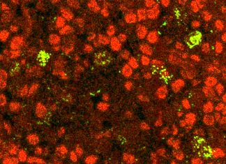 Thymus gland educates nascent immune cells by exposing them to proteins made by thymus cells that mimic various tissues throughout the body