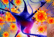 Varicella zoster virus (VZV) may be triggering the onset of Alzheimer’s disease