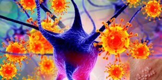 Varicella zoster virus (VZV) may be triggering the onset of Alzheimer’s disease