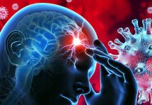 COVID-19 Infections Lead To Higher Risk Of Ischemic Strokes