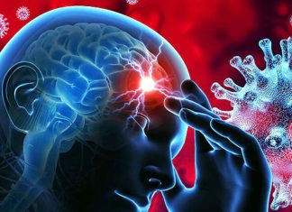 COVID-19 Infections Lead To Higher Risk Of Ischemic Strokes