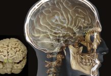 Rapid olfactory decline during aging predicts dementia – Alzheimer’s