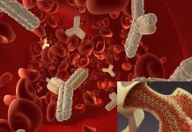 Researchers say bone marrow transplants may be an effective treatment for ALS
