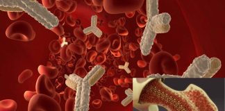 Researchers say bone marrow transplants may be an effective treatment for ALS