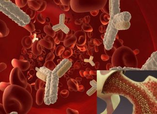 Researchers say bone marrow transplants may be an effective treatment for ALS