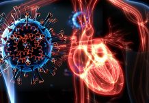French Researchers Identify Two Unique Phenotypes of SARS-CoV-2 Infections Related Myocarditis
