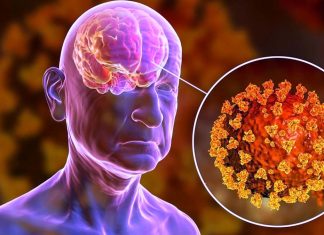 SARS-CoV-2 Infections Can Also Cause Long Term Peripheral Nerve Demyelination And Axonal Loss