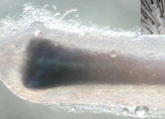 The Chemical Controlling Life and Death in Hair Follicles Identified: New treatment options for baldness and therapies to speed up wound healing