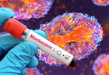 Rilevazione prolungata del DNA del virus del vaiolo delle scimmie nei tamponi nasofaringei, nelle urine e nei campioni di sangue