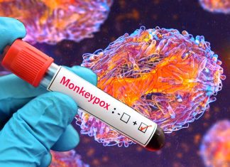 Rilevazione prolungata del DNA del virus del vaiolo delle scimmie nei tamponi nasofaringei, nelle urine e nei campioni di sangue