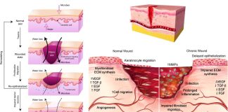 Degradable polythioketal (PTK) urethane (UR) foams with varied hydrophilicity for skin wound healing