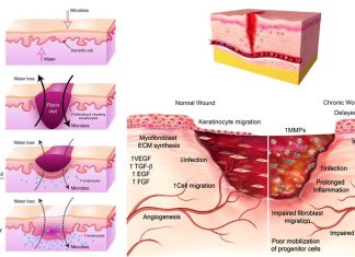 Degradable polythioketal (PTK) urethane (UR) foams with varied hydrophilicity for skin wound healing