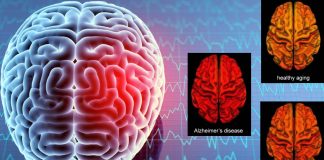 Researchers identified a unique biomarker associated with only the chronic or acute stage of traumatic brain injury