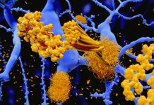 Alzheimer’s disease: the effects of somatostatin on Aβ agglomeration path depending on the presence or absence of metals