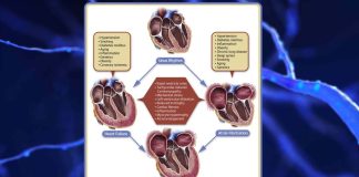 Structural or functional abnormalities within the heart’s left atrium may increase a person’s risk of developing dementia later in life by 35%