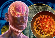 Il COVID-19 può predisporre le persone a condizioni neurologiche irreversibili
