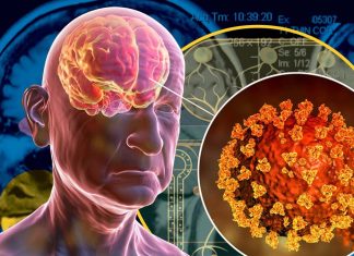 Il COVID-19 può predisporre le persone a condizioni neurologiche irreversibili