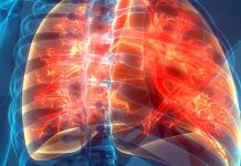 Cystic fibrosis: new treatment approach for children