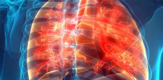 Cystic fibrosis: new treatment approach for children