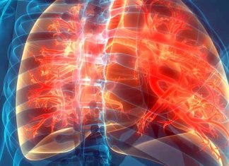 Cystic fibrosis: new treatment approach for children