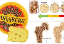 Jarlsberg cheese helps prevent osteopenia