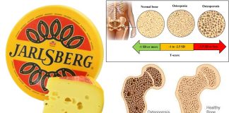 Jarlsberg cheese helps prevent osteopenia