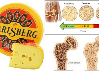 Jarlsberg cheese helps prevent osteopenia