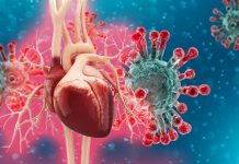 SARS-CoV-2 Infections Results In Decreased Myocardial Blood Flow