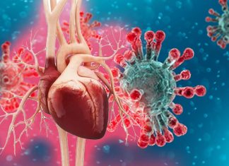 SARS-CoV-2 Infections Results In Decreased Myocardial Blood Flow