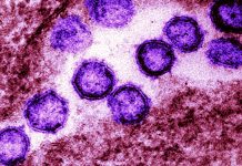 SARS-CoV-2 Spike mutation P272L emerged and transmitted in several viral lineages