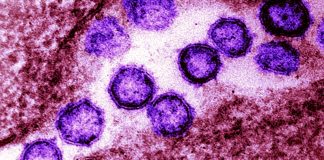 SARS-CoV-2 Spike mutation P272L emerged and transmitted in several viral lineages