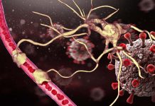 SARS-CoV-2 Infects The Astrocytes Of The Human Brain Using NRP1 Receptors – Causing Damage