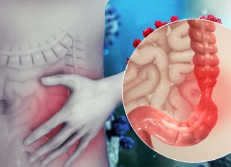 SARS-CoV-2: A Large Number of Individuals Will End Up With Irritable Bowel Syndrome (IBS)