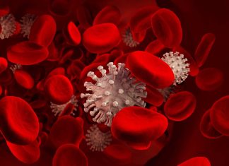 German Study Shows Persistent Capillary Rarefication Even 18 Months After COVID-19 Infection
