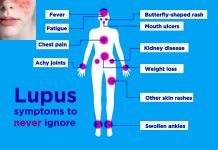 LUPUS: Afimetoran a newly developed pill to treat lupus not only prevents lupus-like symptoms but also reverses signs of organ damage