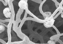 Alzheimer’s: Disease of the microscopic blood vessels that feed the white matter of our brain is associated with worse cognitive function