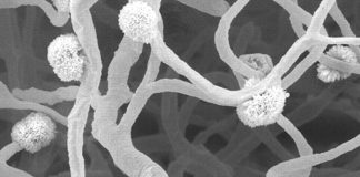 Alzheimer’s: Disease of the microscopic blood vessels that feed the white matter of our brain is associated with worse cognitive function