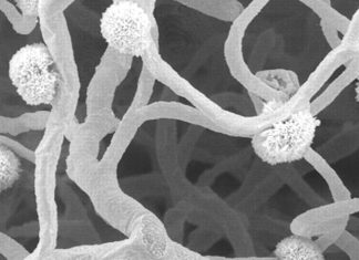 Alzheimer’s: Disease of the microscopic blood vessels that feed the white matter of our brain is associated with worse cognitive function