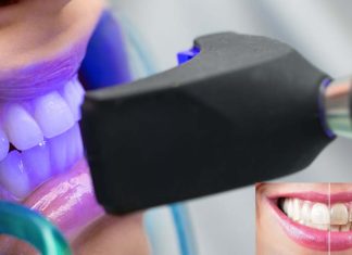 A new treatment whitens teeth and eliminates bacteria without damaging them