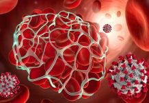 Blood Clots Caused By SARS-CoV-2 Infections Poses A Threat For Fatal Vascular Events For Up To 49 Weeks After Diagnosis