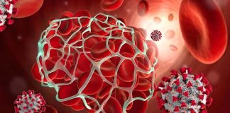 Blood Clots Caused By SARS-CoV-2 Infections Poses A Threat For Fatal Vascular Events For Up To 49 Weeks After Diagnosis