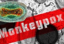 Monkeypox ha una maggiore probabilità di evoluzione durante il periodo di tempo mentre i numeri dei casi sono bassi