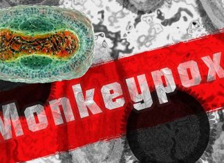 Monkeypox ha una maggiore probabilità di evoluzione durante il periodo di tempo mentre i numeri dei casi sono bassi