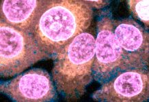 SARS-CoV-2 From Infected Epithelial Cells Disrupts The Endothelial Barrier By Downregulating Claudin-5