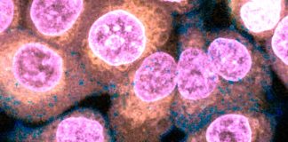 SARS-CoV-2 From Infected Epithelial Cells Disrupts The Endothelial Barrier By Downregulating Claudin-5