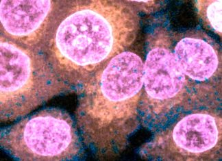 SARS-CoV-2 From Infected Epithelial Cells Disrupts The Endothelial Barrier By Downregulating Claudin-5