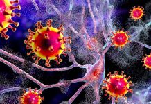 Le infezioni da SARS-CoV-2 aumentano il rischio di vari problemi neurologici